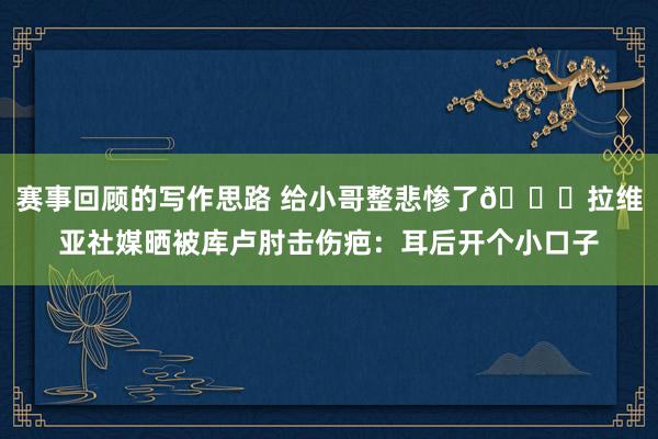 赛事回顾的写作思路 给小哥整悲惨了😅拉维亚社媒晒被库卢肘击伤疤：耳后开个小口子